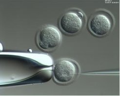 Image Pronucleus injection of DNA into zygotes